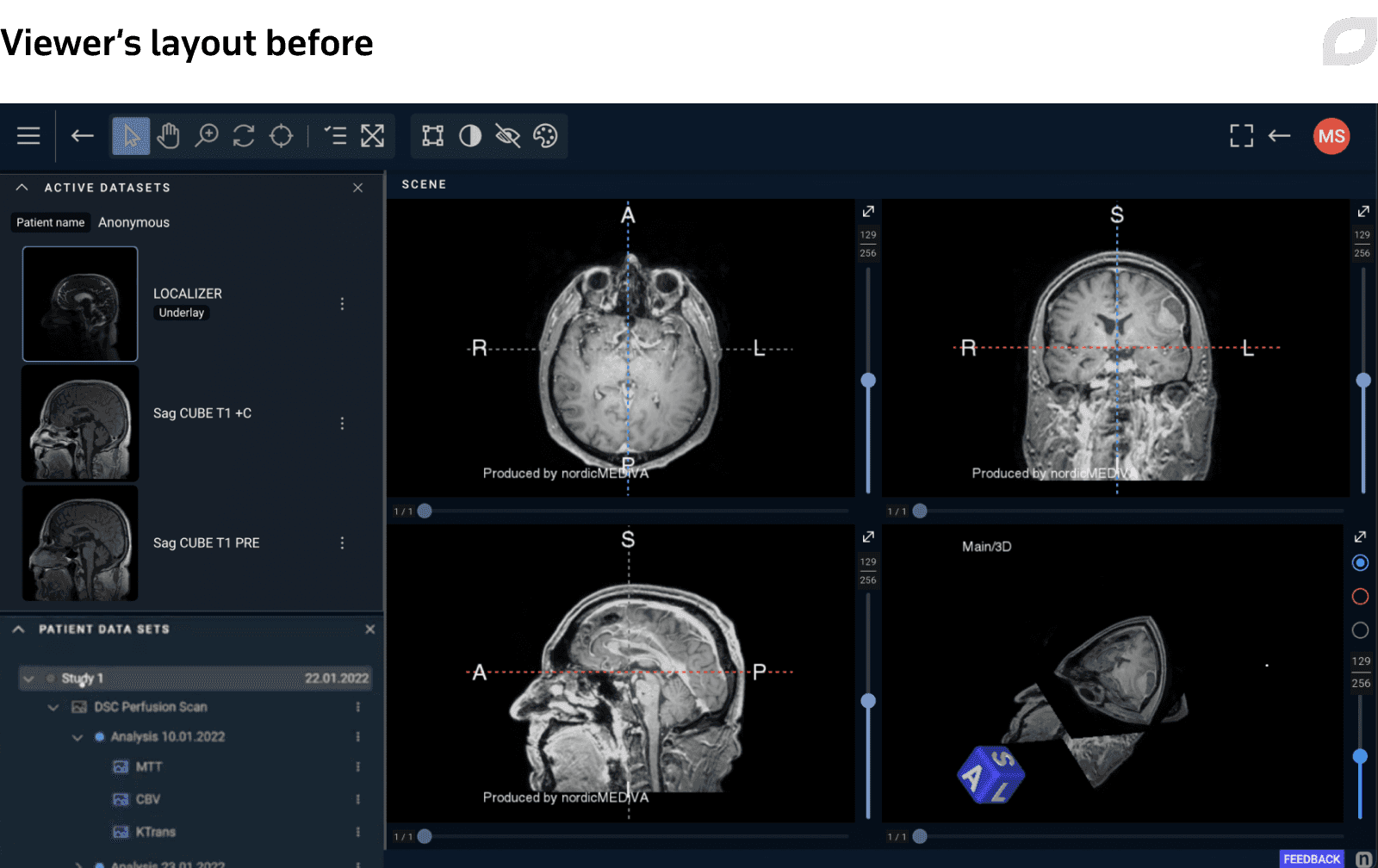 Viewer’s layout before