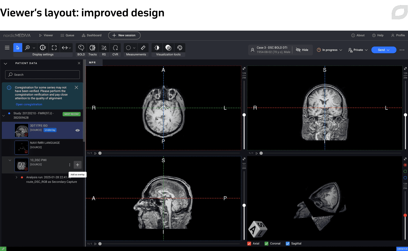 Viewer’s layout: improved design